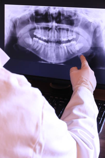Best Emergency Dentist for Knocked-Out Tooth in Old Brookville, NY