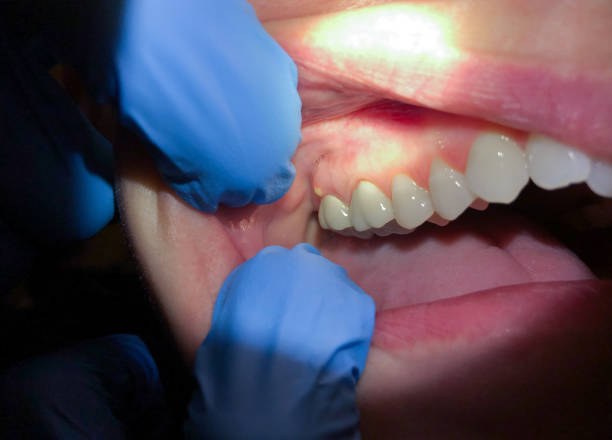 Best Mobile Emergency Dentist in Old Brookville, NY